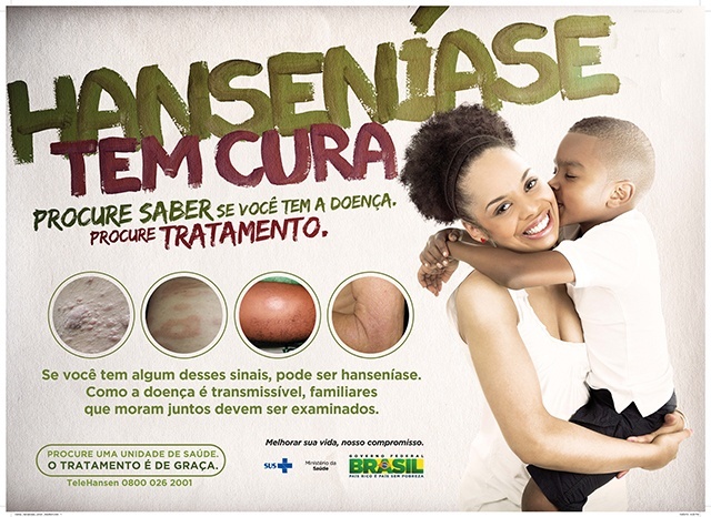 Prefeitura de Maceió  Dia Mundial Contra a Hanseníase: Saúde reforça…